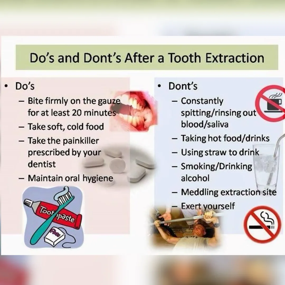 Post Op Care after Dental Surgical Procedures