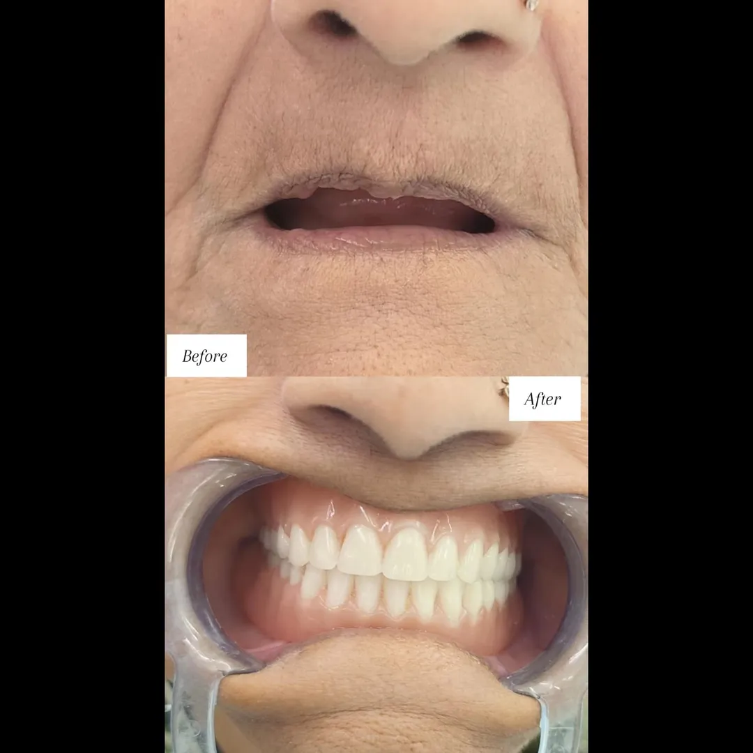 Denture Treatment In vashi