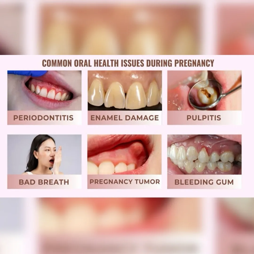 Gingival Problems During Pregnancy