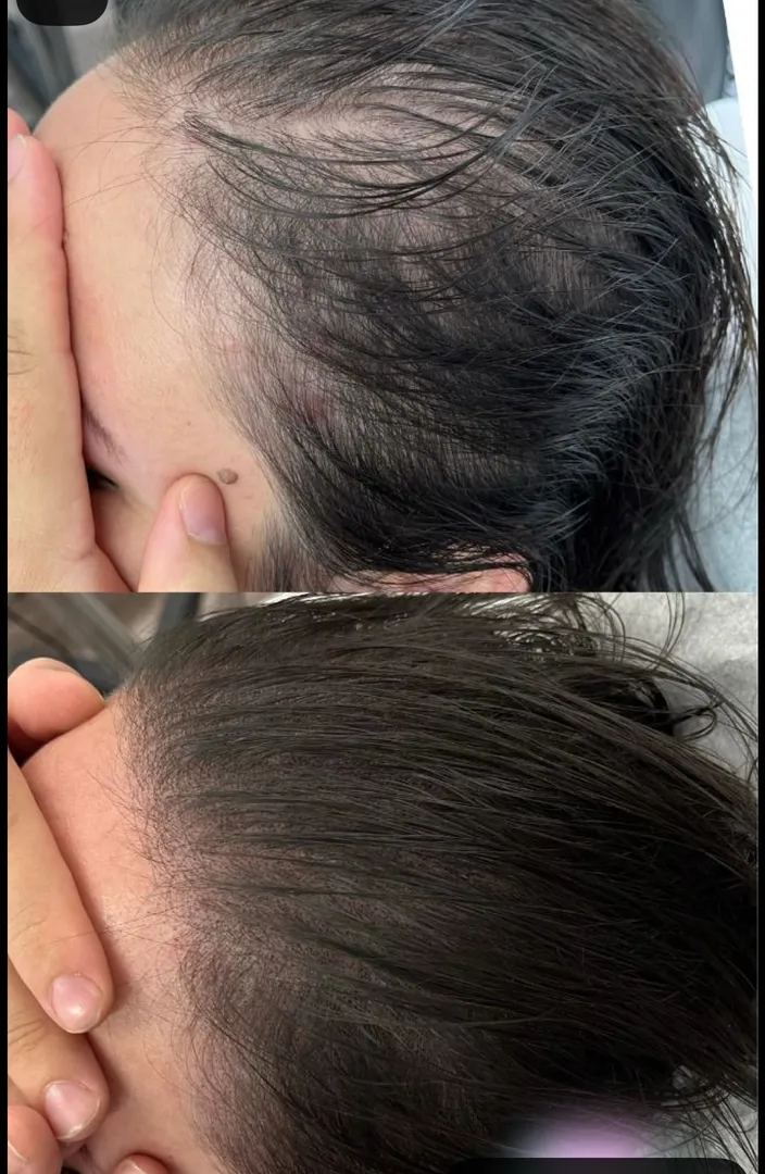 best hairfall treatment in nashik
best dermatologist in nashik
hairfall treatment
prp cost