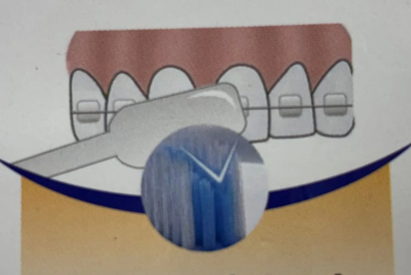 Correct Brushing Technique – Step-by-Step Guide