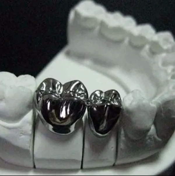 Full metal crown Treatment In Vashi