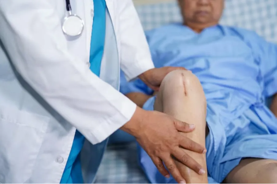 Knee Replacement Surgeon in Nagarbhavi – Restoring Confident Movement