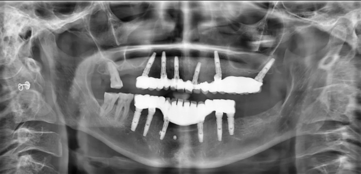 How Digital X-Rays Improve Diagnosis and Safety
