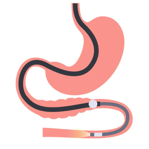 Double Balloon Enteroscopy Procedure in Mumbai | Advanced Diagnostic Endoscopy