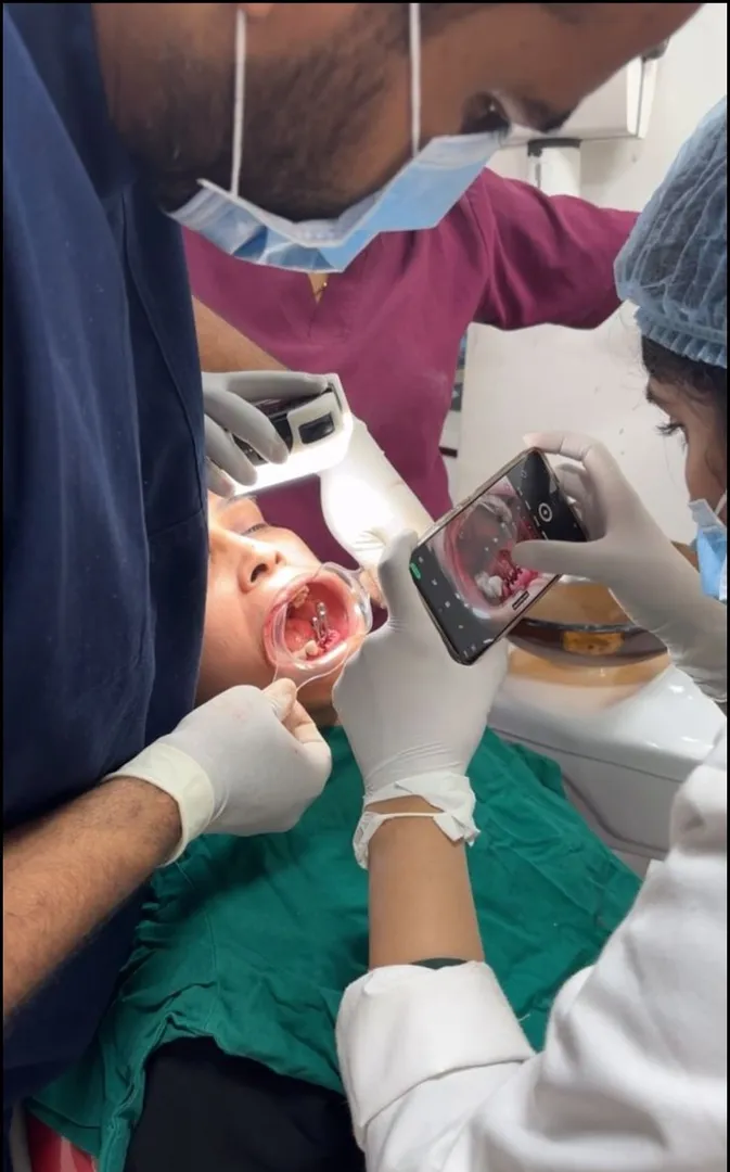 Is Dental Implant Surgery Painful? Honest Answers for Patients