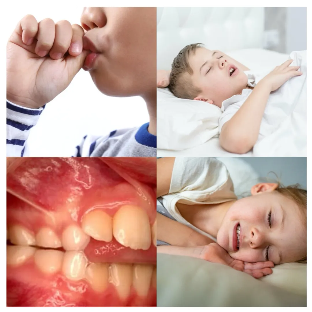 Parafunctional Habits in Children & Their Management
