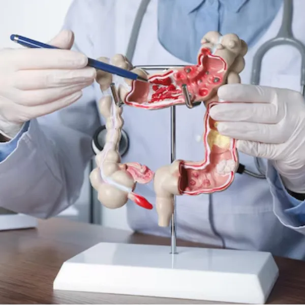 Laparoscopic Colonic Surgery in Mumbai Central – Minimally Invasive Solutions for Colon Health