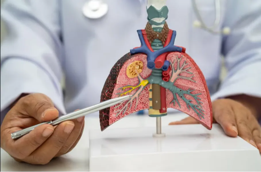 Endobronchial Ultrasound (EBUS) in Jaipur: A Pioneering Lung Cancer Diagnostic Tool