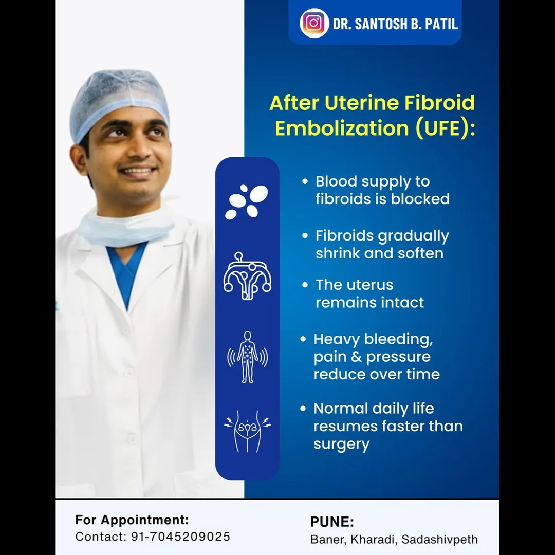 What Happens to Your Uterus After Embolization