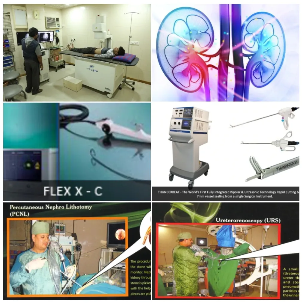 Urology Treatment in Ahmedabad