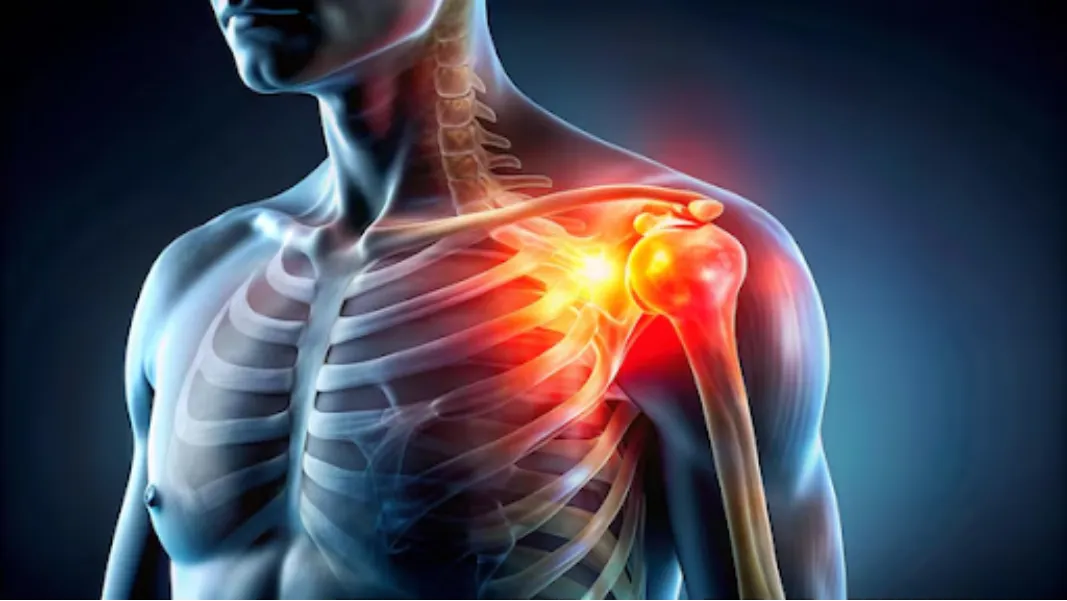 Shoulder Instability Repair in Bangalore – Regain Strength and Freedom of Movement