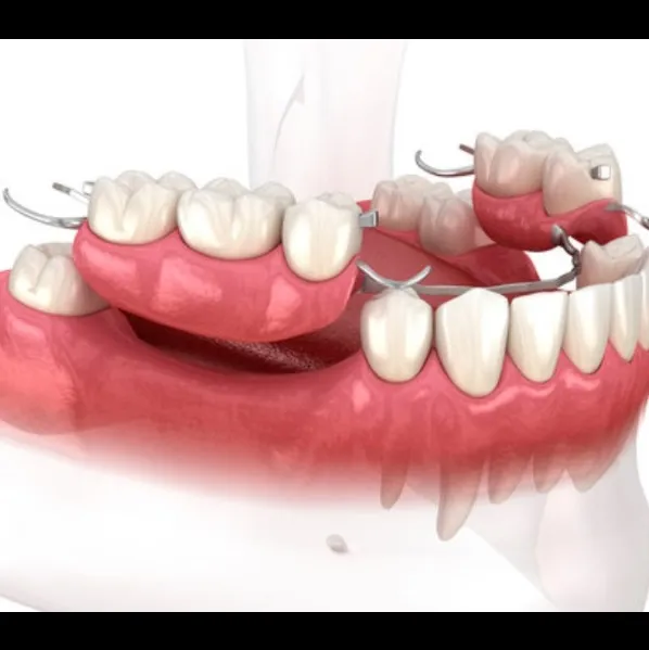 Removal partial Dentures Treatment In Vashi