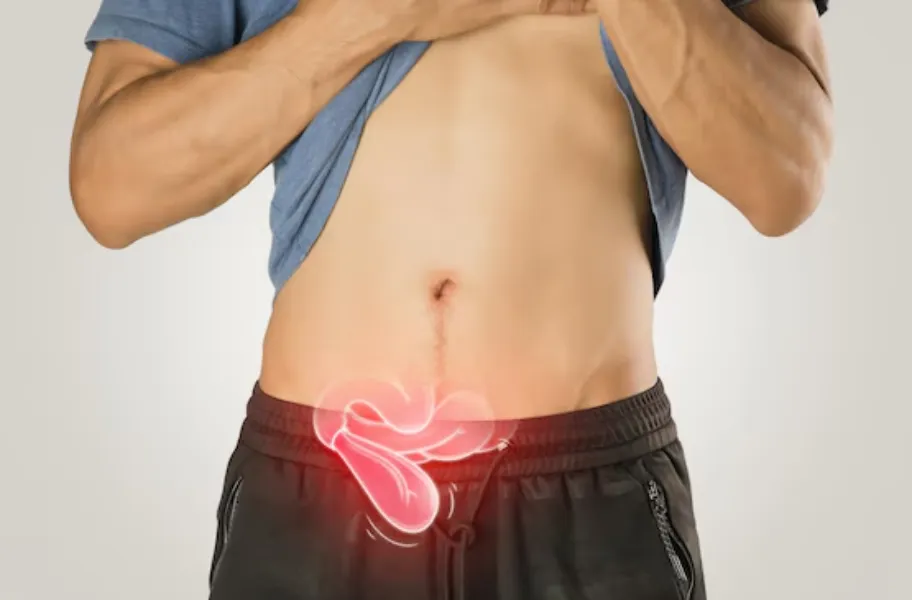 Umbilical Hernia Surgery in Sion for Relief and Long-Term Healing