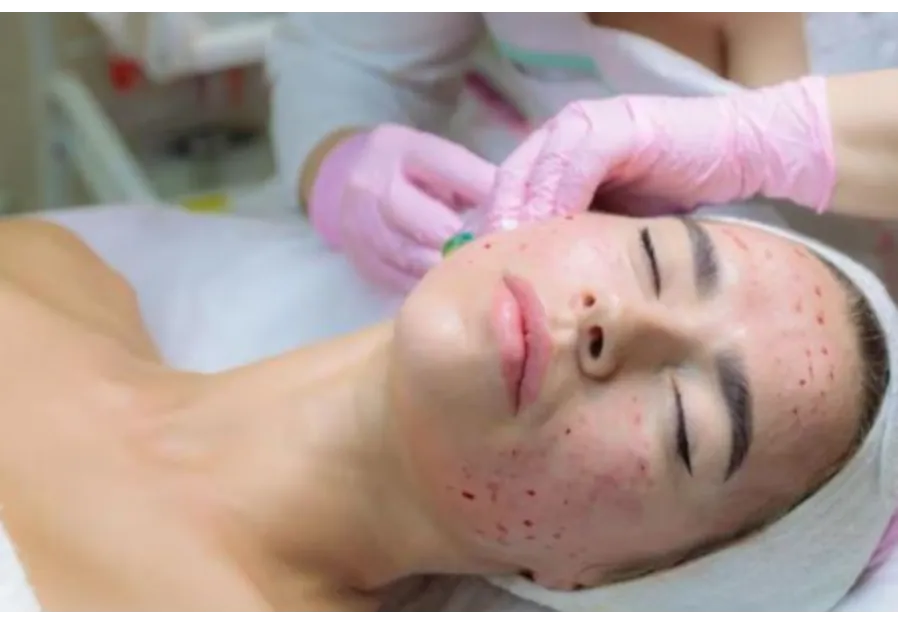 Vampire Facial in Nashik: Rejuvenate and Revitalize Your Skin Naturally