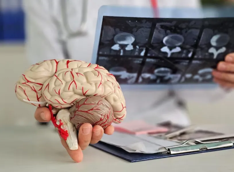 Stroke Treatment in Powai: Timely Intervention for Better Outcomes