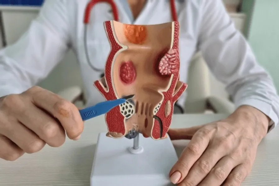 Best Laser Piles Doctor in Pune _ Dr Gowri Singh !