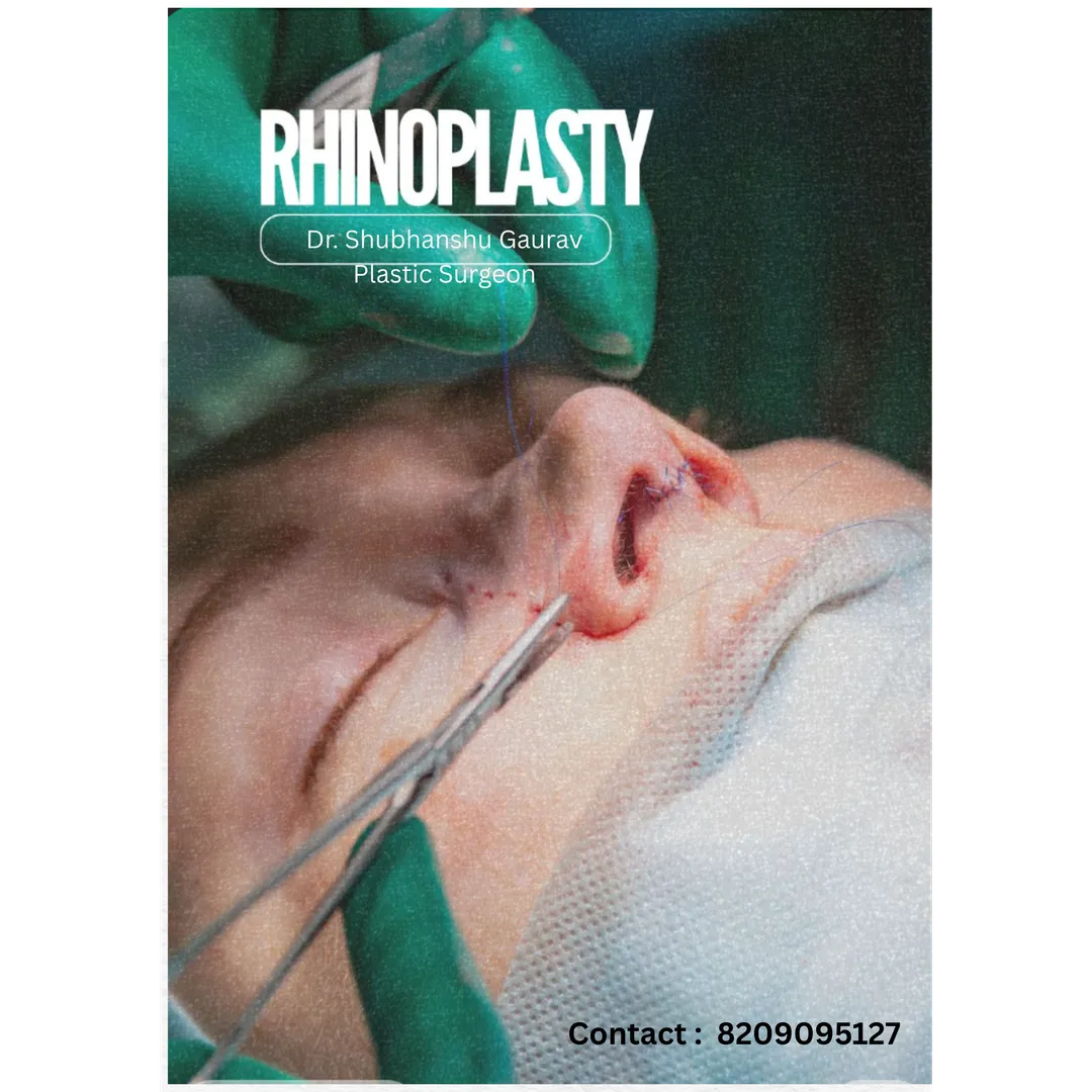 My Approach to Rhinoplasty – Training, Philosophy & Surgical Precision - Best Nosejob In Mumbai