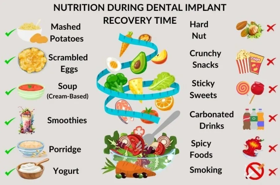 Can I Eat Normally After Getting Dental Implants?