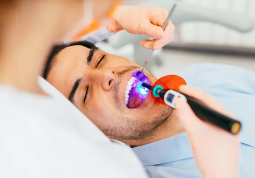 Dental Laser Treatments in R.T Nagar – Precision Dentistry with Added Comfort