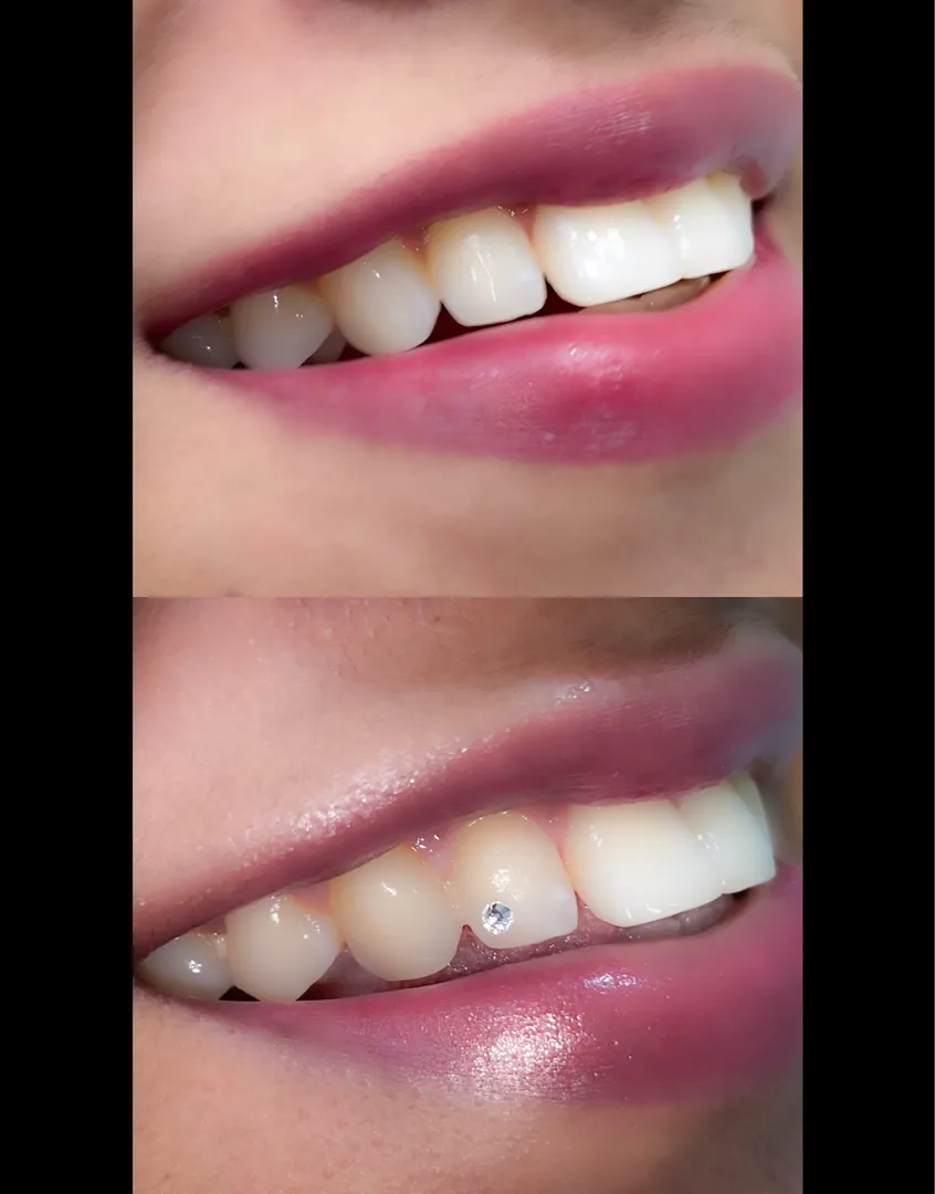 Dental clinic near Swargate