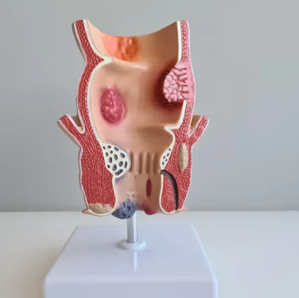 Best Piles Laser Surgeon in Chembur – Advanced Treatment for Lasting Relief