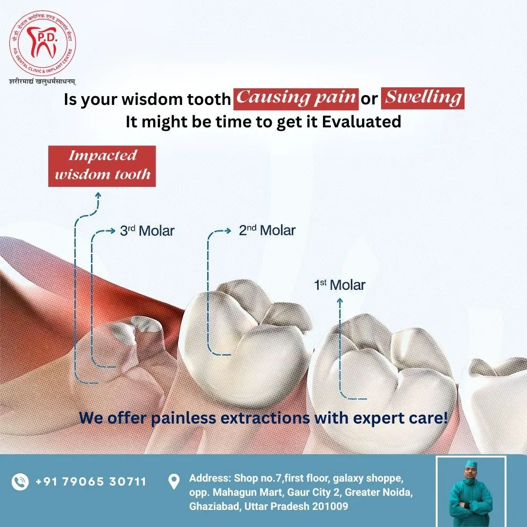 Impacted Tooth Surgical Extraction | Safe Wisdom Tooth Removal | P.D. Dental Clinic