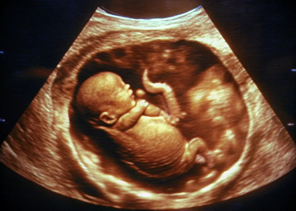 3D / 4D Pregnancy Sonography in Nashik – Seeing Growth with Reassurance