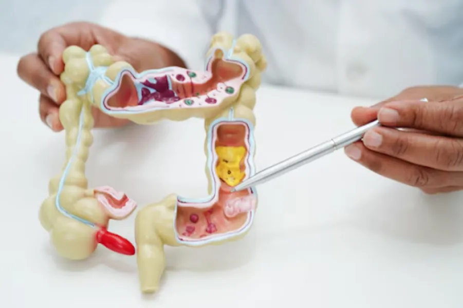 Colonic Polyps Detection in Mumbai | Advanced Preventive Digestive Care