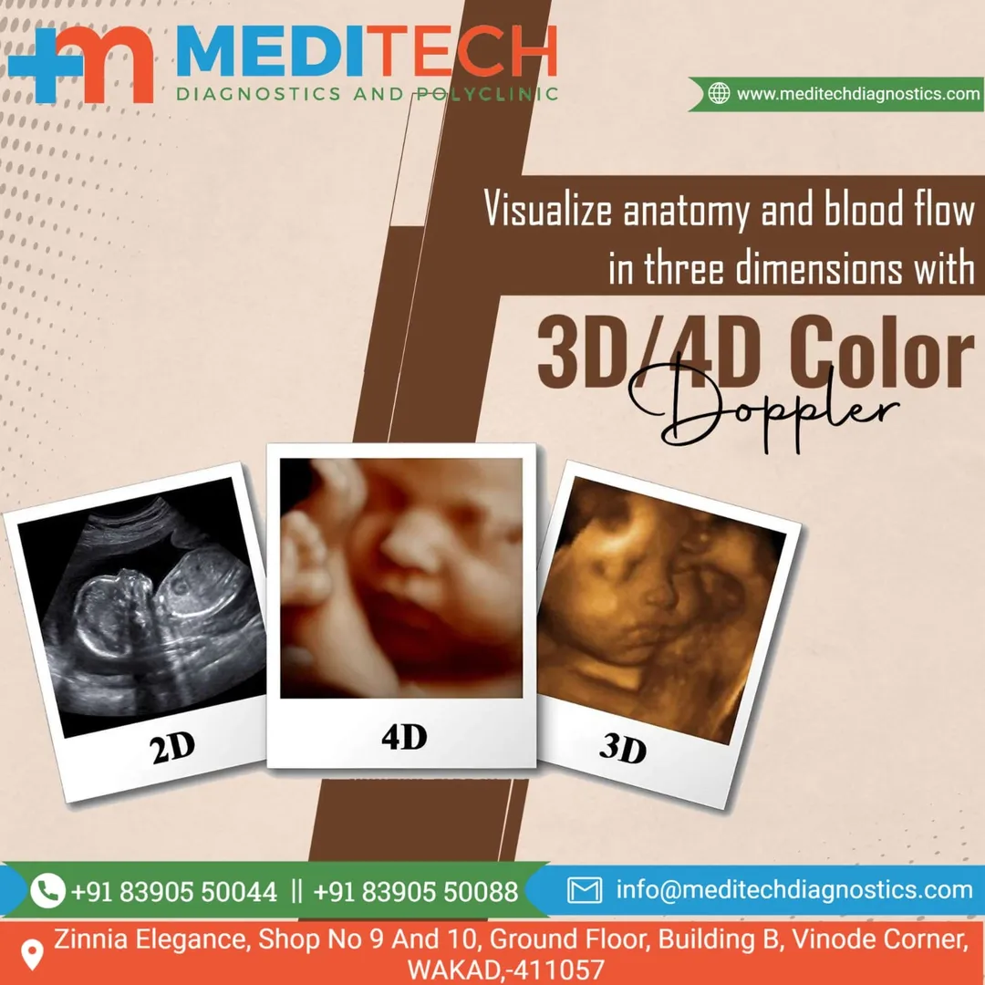 Best 3D/4D Color Doppler Centre in Hinjewadi | Wakad | Ravet | PCMC |