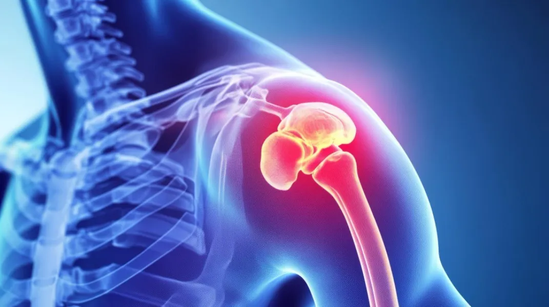 Rotator Cuff Decompression and Repair in Bangalore – Restore Shoulder Strength