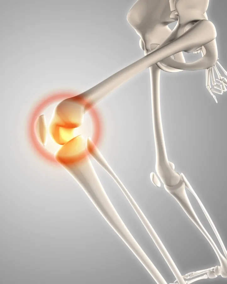 Affordable Knee Replacement Surgery in Mukherjee Nagar – Thoughtful Care Without Compromise