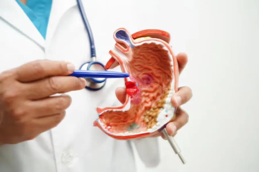 Ulcer Treatment in Kolathur, Chennai - Effective Care for Faster Healing