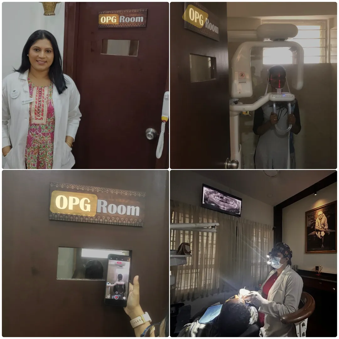 OPG in bangalore , sadashivanagar
