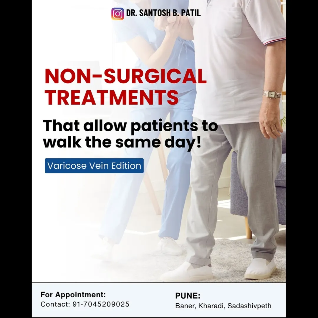 best doctor for Non-Surgical Treatments That Allow Patients to Walk the Same Day Varicose Vein