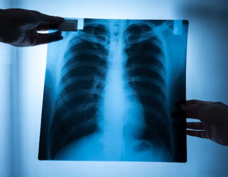 X Ray in Thane - Seeing What Words Cannot Explain