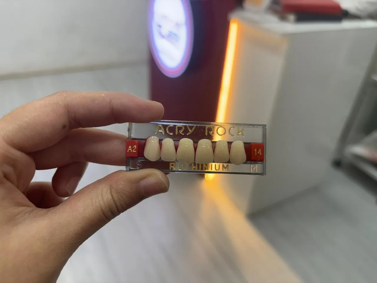 How Long Does Dental Veneers Take? Timeline Explained by Dentists in Thane (Nitin Company Area)