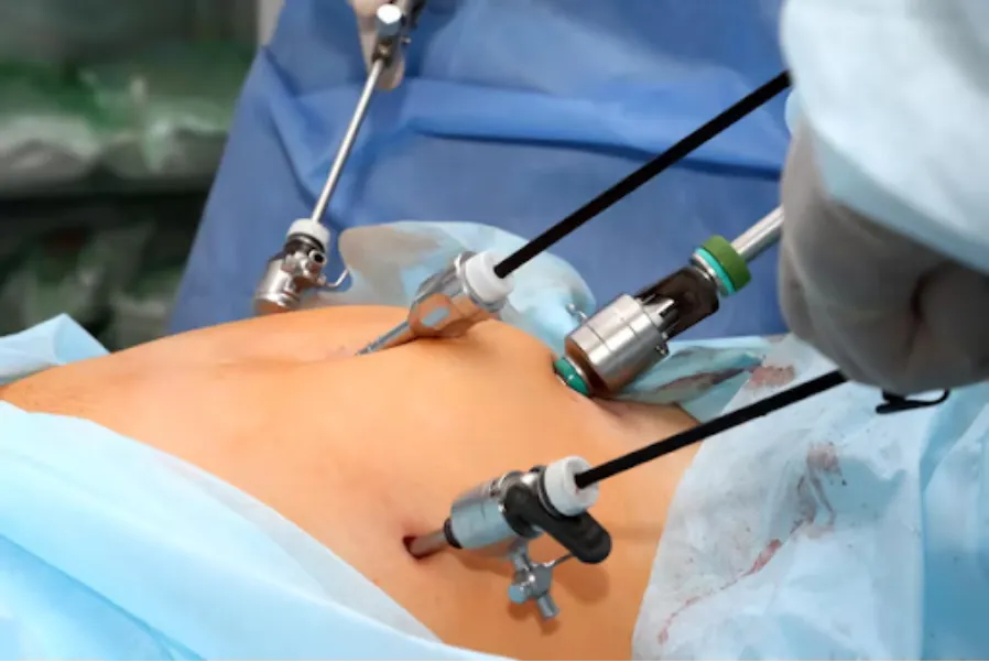 Laparoscopic Digestive Surgery in Thane | Complete Minimally Invasive Care
