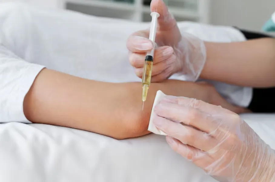 PRP Therapy in Delhi A Natural Approach to Joint and Tissue Healing