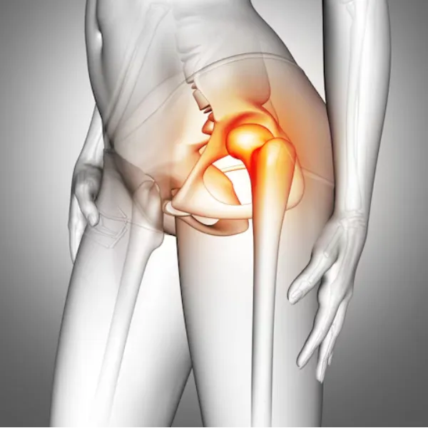 Total Hip Replacement Surgeon in Noida – Restoring Hip Mobility