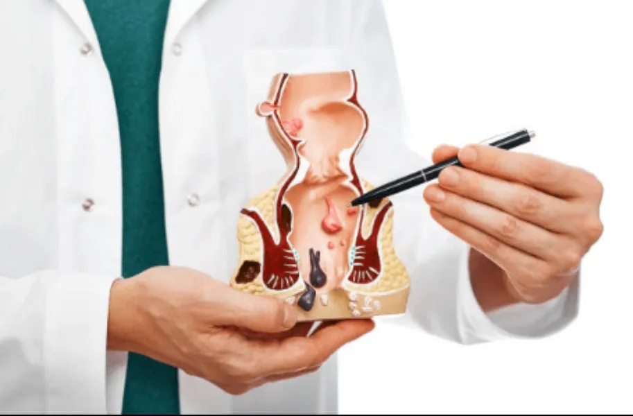 Proctologist in Wakad – Expert Care for Rectal and Anal Health