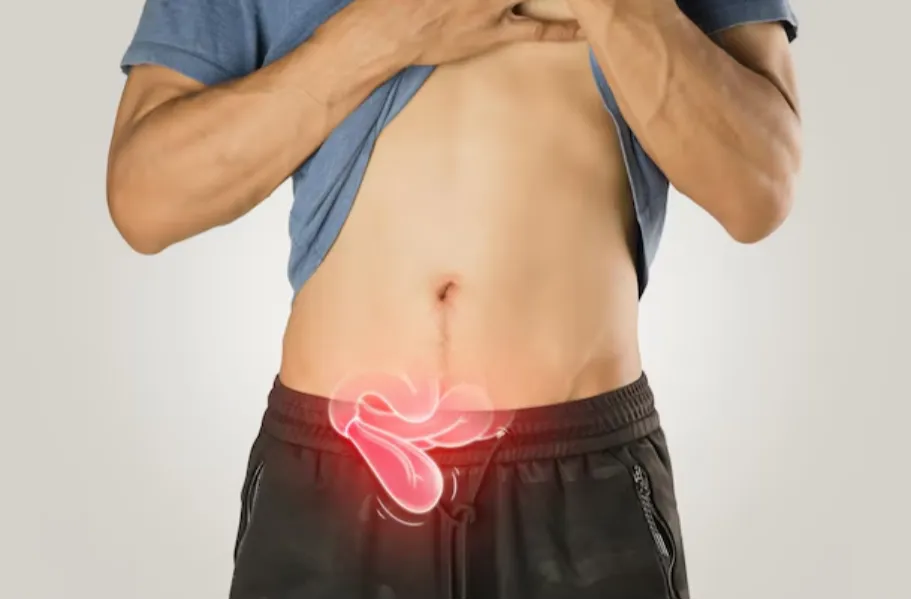 Hernia Surgery in Goregaon – Addressing Discomfort Before It Worsens