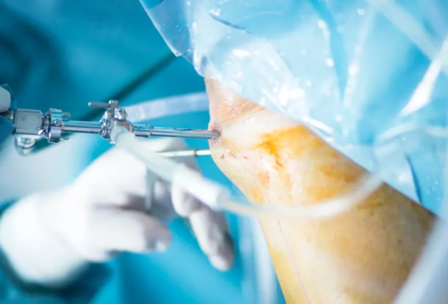 Meniscus Repair Surgery in Noida – Preserving Knee Function Naturally
