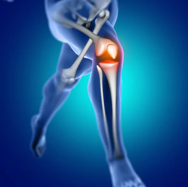 Advanced Knee Replacement Surgery in Pitampura – Restoring Mobility With Precision