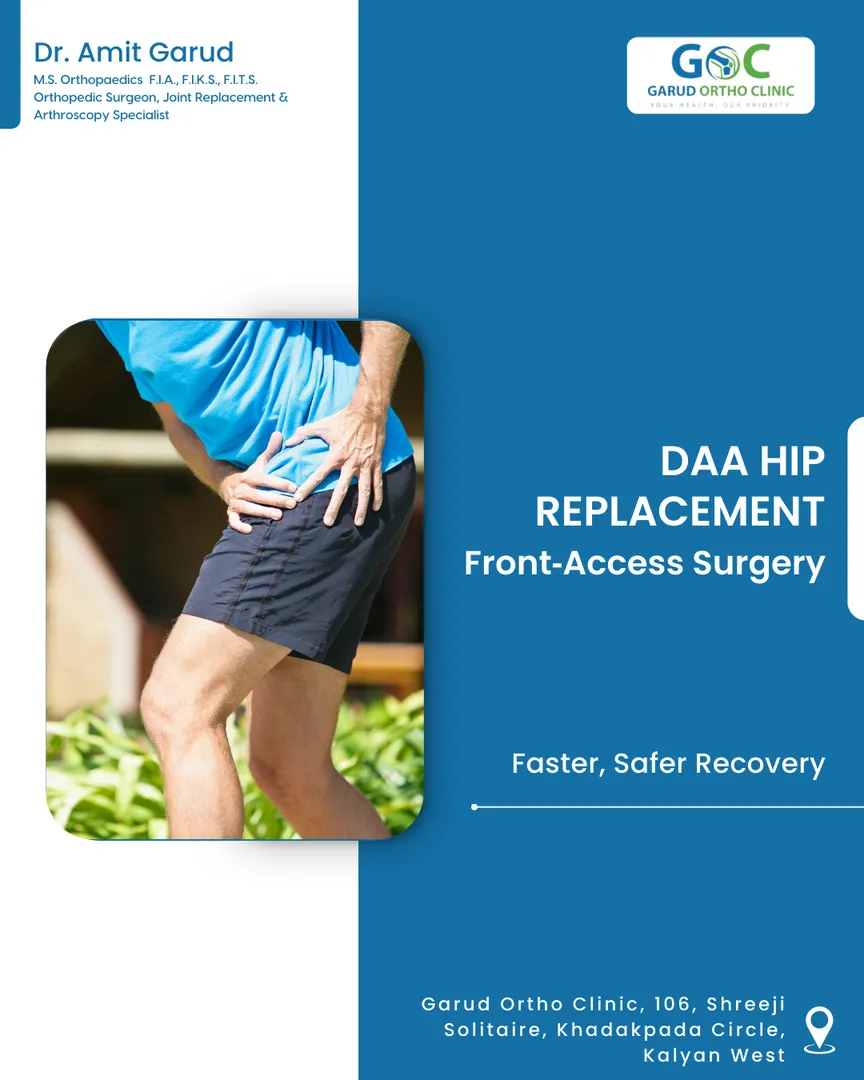 What Is Direct Anterior Approach (DAA) Hip Replacement?