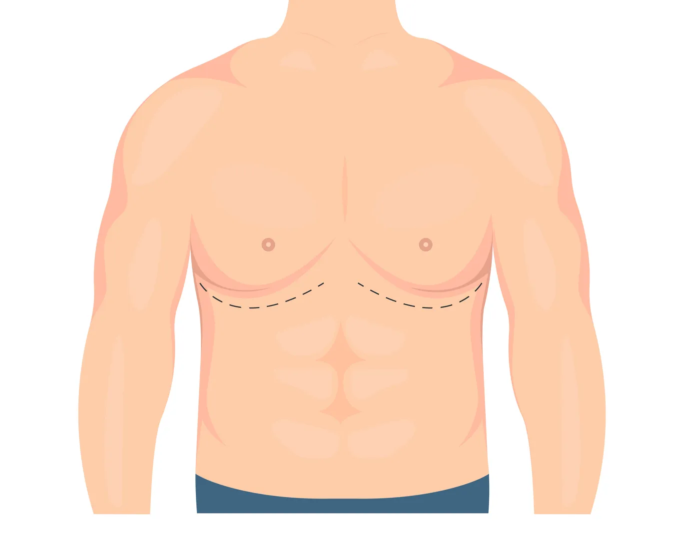 Gynaecomastia Surgery in Bengaluru – Effective Male Chest Contouring Solutions
