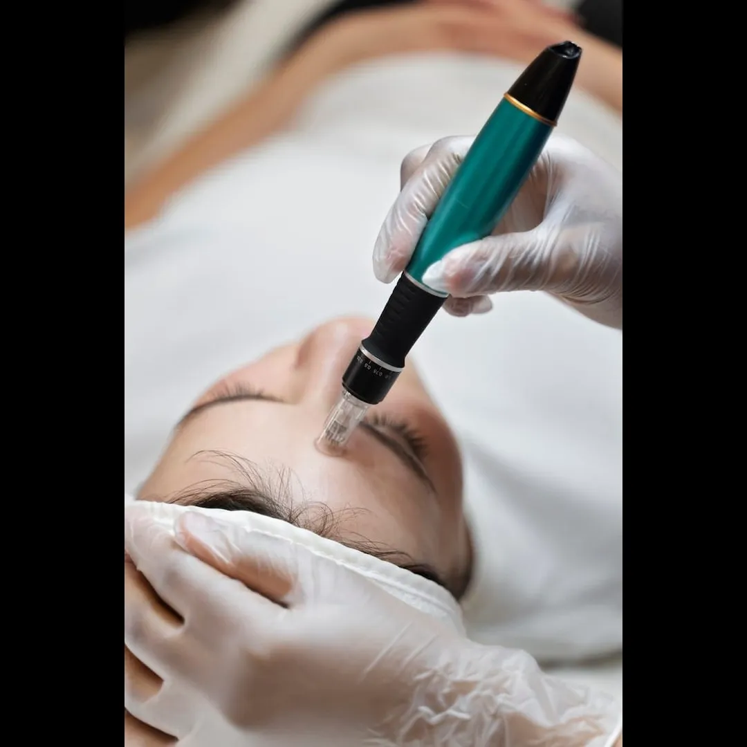 Derma pen Treatment In Vashi