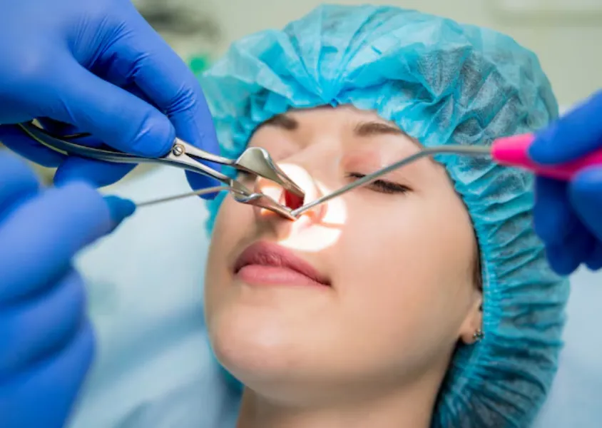 Endoscopic Sinus Treatment in Nashik – Minimally Invasive Relief from Chronic Sinusitis