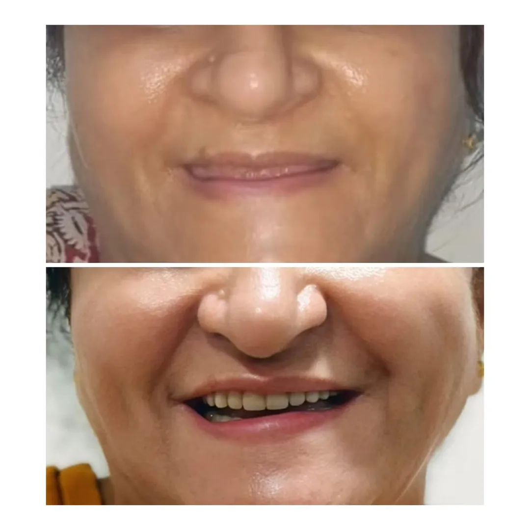 Smile Makeover vs Alternatives: What Dentists in Thane (Nitin Company Area) Recommend