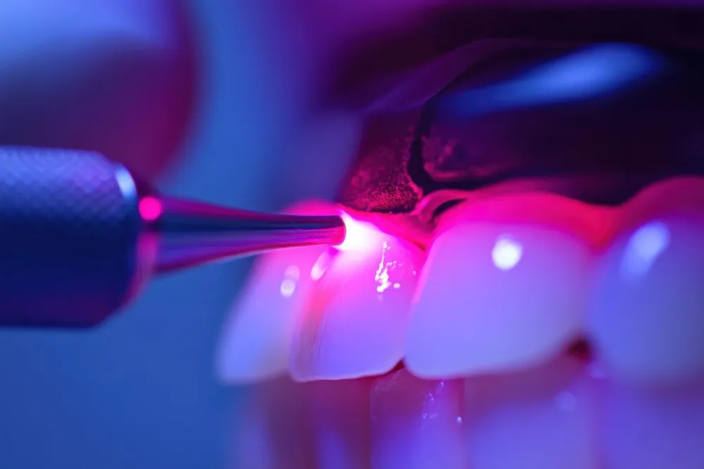 Dental Laser Treatments in Ashwath Nagar - Modern Dentistry for Gentle Care